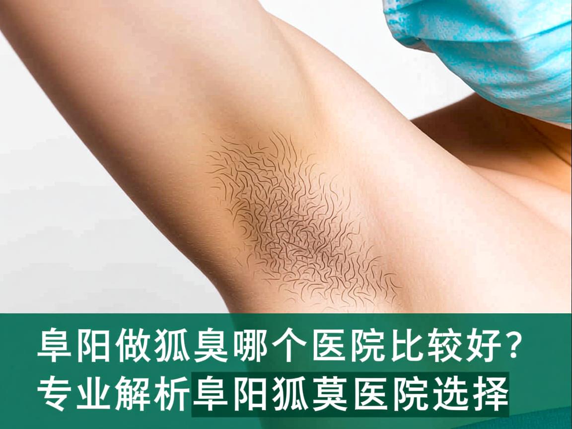 阜阳做狐臭哪个医院比较好?专业解析阜阳狐臭医院选择 阜阳做狐臭哪个医院比较好?专业解析阜阳狐臭医院选择
