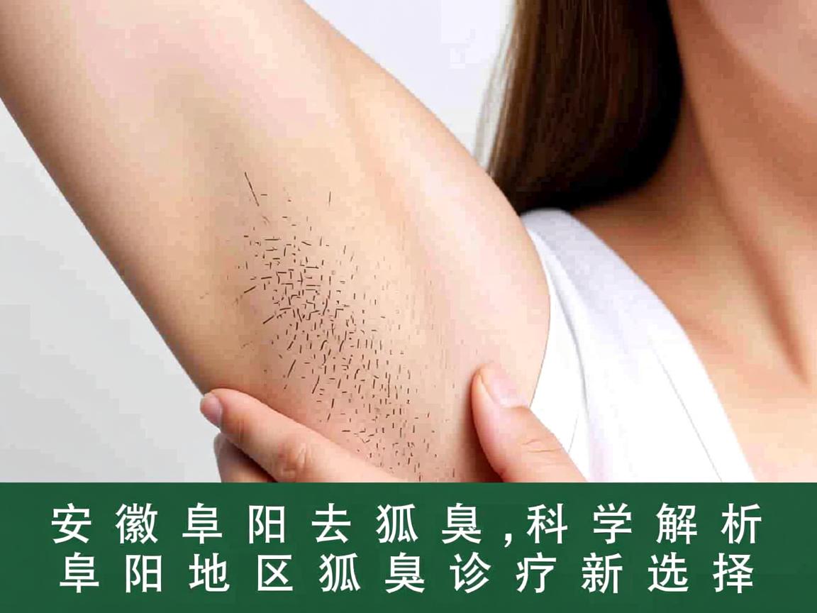安徽阜阳去狐臭,科学解析阜阳地区狐臭诊疗新选择 安徽阜阳去狐臭,科学解析阜阳地区狐臭诊疗新选择