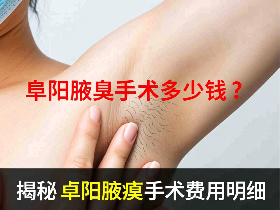 阜阳腋臭手术多少钱?揭秘阜阳腋臭手术费用明细 阜阳腋臭手术多少钱?揭秘阜阳腋臭手术费用明细