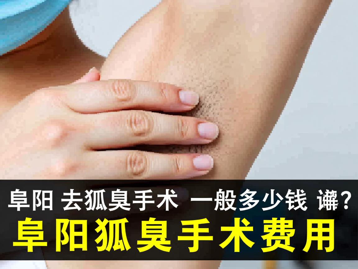 阜阳去狐臭手术一般多少钱？详解阜阳狐臭手术费用