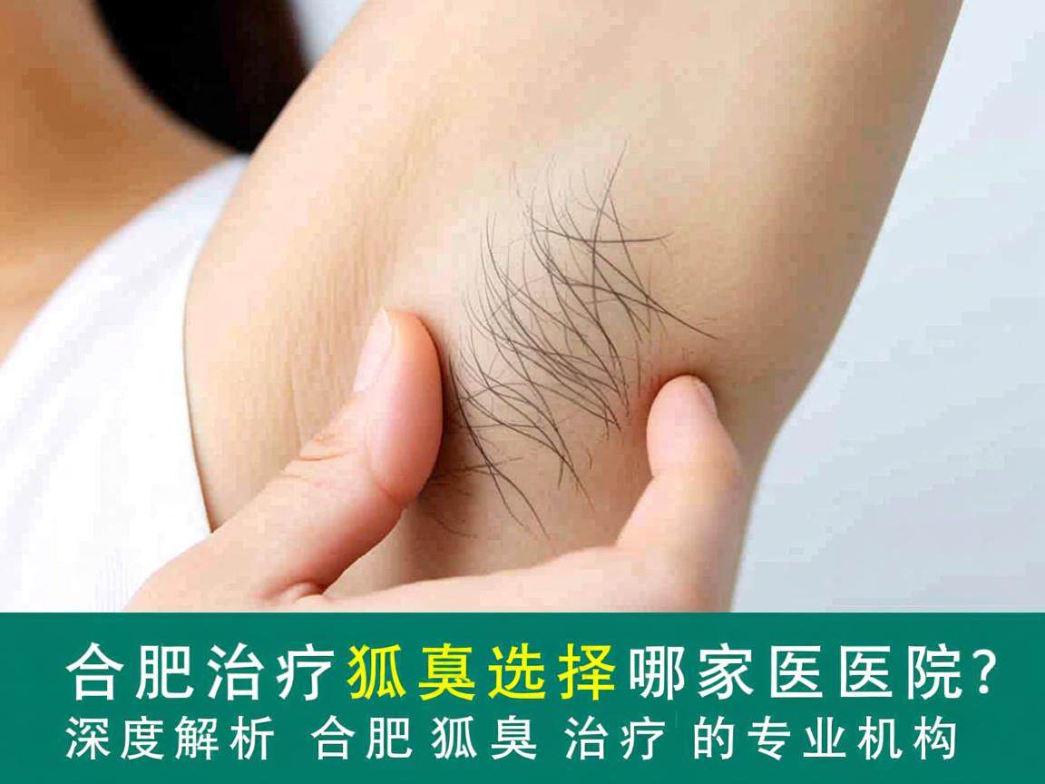 合肥治疗狐臭选择哪家医院？深度解析合肥狐臭治疗的专业机构