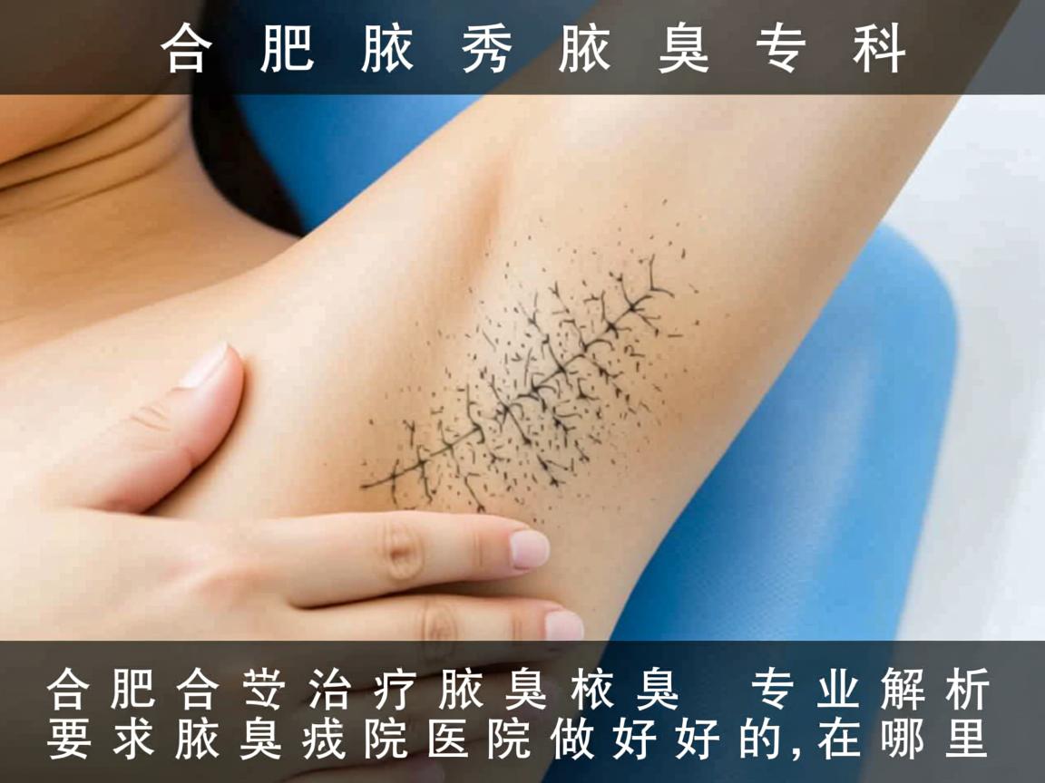 合肥腋秀腋臭专科,专业解析合肥治疗腋臭医院做好的在哪里 合肥腋秀腋臭专科,专业解析合肥治疗腋臭医院做好的在哪里